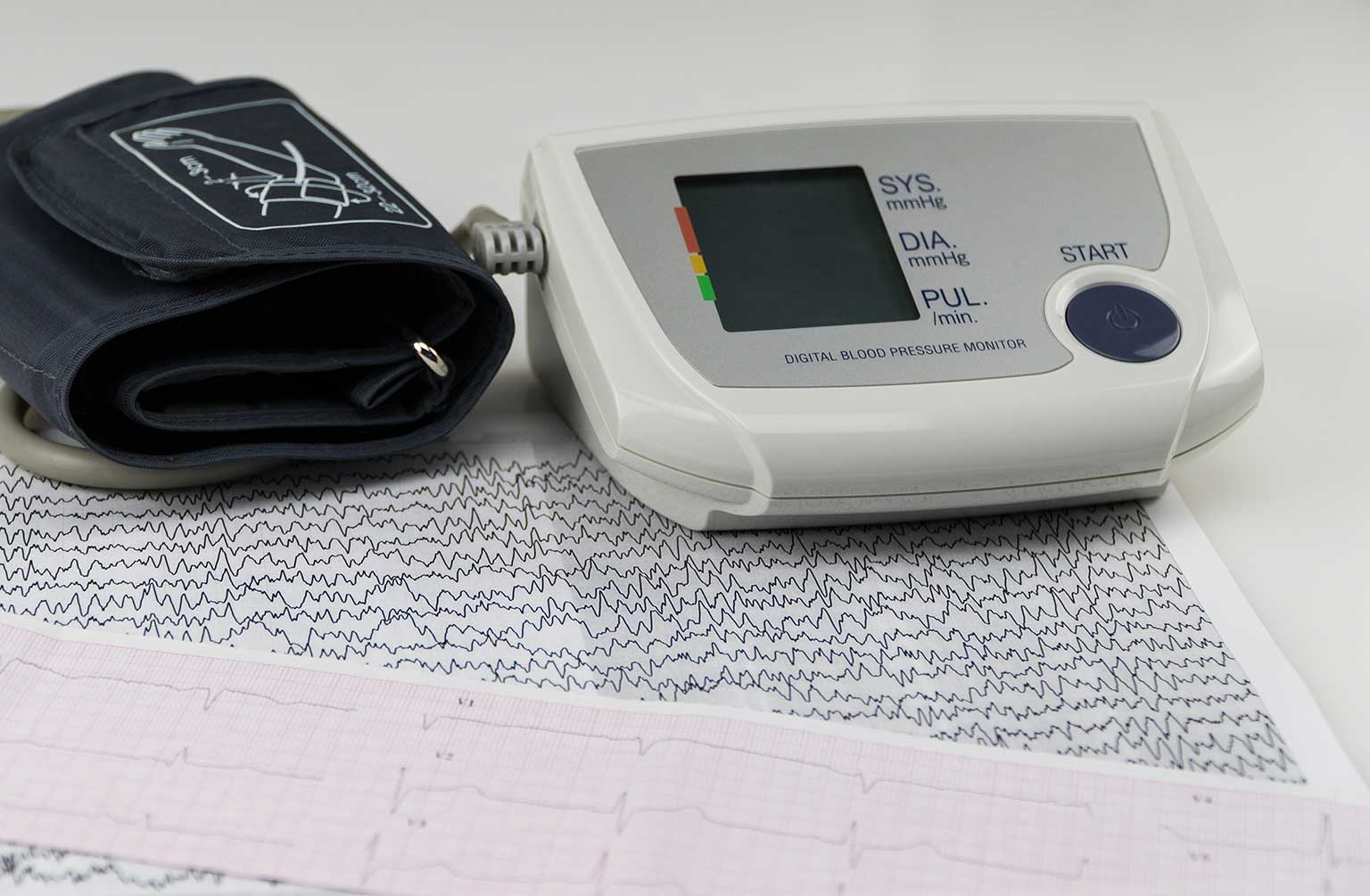 What Is An Electrocardiogram Test And What Does It Show